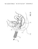 ERGONOMIC, LIGHTED UTERINE MANIPULATOR WITH CAUTERY diagram and image