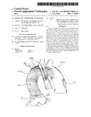 DEVICE AND METHOD FOR ANASTOMOSIS diagram and image