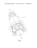 DEVICE AND METHOD FOR ANASTOMOSIS diagram and image