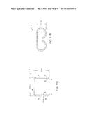 DEVICE AND METHOD FOR ANASTOMOSIS diagram and image