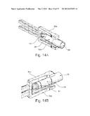 DEVICE AND METHOD FOR ANASTOMOSIS diagram and image