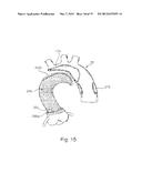 DEVICE AND METHOD FOR ANASTOMOSIS diagram and image