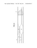 BALLOON CATHETER WITH LITHOTRIPSY AMPLIFICATION SYSTEM diagram and image