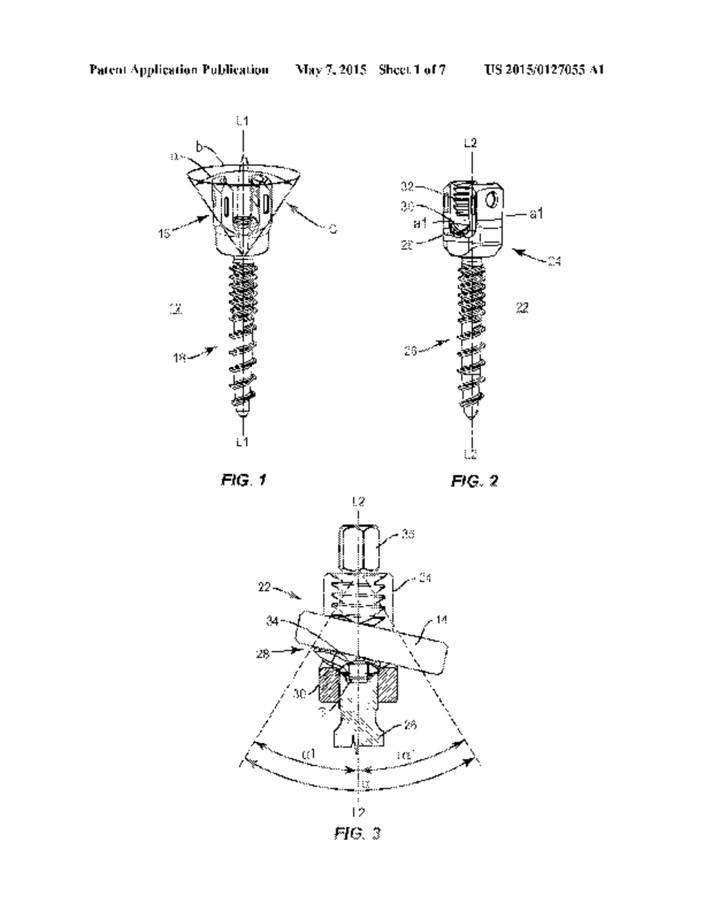 SPINAL CORRECTION SYSTEM AND METHOD - diagram, schematic, and image 02