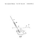 SURGICAL SYSTEM, DEVICE, AND METHOD FOR IMPLANTING A SURGICAL DEVICE     WITHOUT THE USE OF A GUIDE WIRE diagram and image