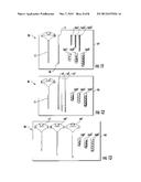 SURGICAL SYSTEM, DEVICE, AND METHOD FOR IMPLANTING A SURGICAL DEVICE     WITHOUT THE USE OF A GUIDE WIRE diagram and image