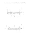 METHOD, SYSTEM, AND APPARATUS FOR DERMATOLOGICAL TREATMENT diagram and image