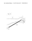 LIVING BODY STIMULATING ELECTRODE, LIVING BODY STIMULATING ELECTRODE     APPARATUS, AND METHOD FOR PRODUCING LIVING BODY STIMULATING ELECTRODE diagram and image