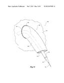 STENT GRAFT WITH VALVE ARRANGEMENT diagram and image