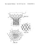 Heart Valve Prosthesis and Methods of Manufacture and Use diagram and image