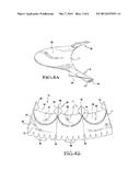 Heart Valve Prosthesis and Methods of Manufacture and Use diagram and image