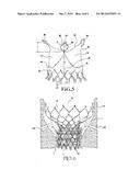 Heart Valve Prosthesis and Methods of Manufacture and Use diagram and image