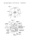 METHODS OF IMPLANTING AN ANNULOPLASTY RING FOR REDUCED DEHISCENCE diagram and image