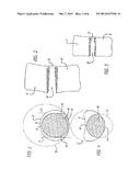 SPINAL FUSION IMPLANT WITH BONE SCREWS AND A BONE SCREW LOCK diagram and image