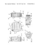 SPINAL FUSION IMPLANT WITH BONE SCREWS AND A BONE SCREW LOCK diagram and image