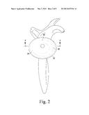 METHOD OF IMPLANTING A REVERSE SHOULDER ORTHOPAEDIC IMPLANT HAVING A     METAGLENE COMPONENT WITH A SCREW LOCKING CAP diagram and image