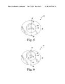 METHOD OF IMPLANTING A REVERSE SHOULDER ORTHOPAEDIC IMPLANT HAVING A     METAGLENE COMPONENT WITH A SCREW LOCKING CAP diagram and image