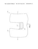 ANTERIOR STABILIZED KNEE IMPLANT diagram and image