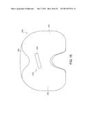 ANTERIOR STABILIZED KNEE IMPLANT diagram and image