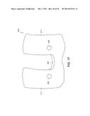 ANTERIOR STABILIZED KNEE IMPLANT diagram and image