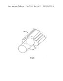 OPEN LUMEN STENT diagram and image