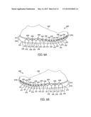 ARTICULATED SOLE STRUCTURE WITH SIPES FORMING HEXAGONAL SOLE ELEMENTS diagram and image