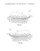 ARTICULATED SOLE STRUCTURE WITH SIPES FORMING HEXAGONAL SOLE ELEMENTS diagram and image