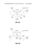 SEGMENTATION OF SURROUND VIEW DATA diagram and image