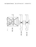 GANTRY IMAGE GUIDED RADIOTHERAPY SYSTEM AND RELATED TREATMENT DELIVERY     METHODS diagram and image