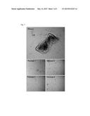 PTERYGIUM ANIMAL MODEL USING HUMAN PTERYGIAL EPITHELIAL CELLS diagram and image