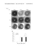 PTERYGIUM ANIMAL MODEL USING HUMAN PTERYGIAL EPITHELIAL CELLS diagram and image