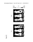 COMBINATION THERAPY INVOLVING ANTIBODIES AGAINST CLAUDIN 18.2 FOR     TREATMENT OF CANCER diagram and image