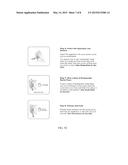 METHOD OF TREATING ULCERATIVE COLITIS diagram and image