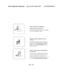 METHOD OF TREATING ULCERATIVE COLITIS diagram and image