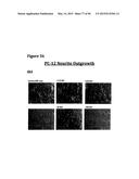 METHODS OF PREVENTING OR TREATING PAIN USING ANTI-NGF ANTIBODIES THAT     SELECTIVELY INHIBIT THE ASSOCIATION OF NGF WITH TRKA, WITHOUT AFFECTING     THE ASSOCIATION OF NGF WITH P75 diagram and image