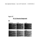 METHODS OF PREVENTING OR TREATING PAIN USING ANTI-NGF ANTIBODIES THAT     SELECTIVELY INHIBIT THE ASSOCIATION OF NGF WITH TRKA, WITHOUT AFFECTING     THE ASSOCIATION OF NGF WITH P75 diagram and image