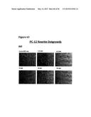 METHODS OF PREVENTING OR TREATING PAIN USING ANTI-NGF ANTIBODIES THAT     SELECTIVELY INHIBIT THE ASSOCIATION OF NGF WITH TRKA, WITHOUT AFFECTING     THE ASSOCIATION OF NGF WITH P75 diagram and image