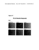 METHODS OF PREVENTING OR TREATING PAIN USING ANTI-NGF ANTIBODIES THAT     SELECTIVELY INHIBIT THE ASSOCIATION OF NGF WITH TRKA, WITHOUT AFFECTING     THE ASSOCIATION OF NGF WITH P75 diagram and image