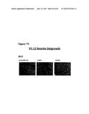 METHODS OF PREVENTING OR TREATING PAIN USING ANTI-NGF ANTIBODIES THAT     SELECTIVELY INHIBIT THE ASSOCIATION OF NGF WITH TRKA, WITHOUT AFFECTING     THE ASSOCIATION OF NGF WITH P75 diagram and image