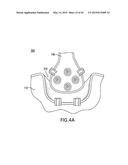 AGENTS AND DEVICES FOR AFFECTING NERVE FUNCTION diagram and image