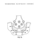 AGENTS AND DEVICES FOR AFFECTING NERVE FUNCTION diagram and image