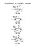 AGENTS AND DEVICES FOR AFFECTING NERVE FUNCTION diagram and image