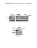 ANTI-CANCER EXTRACT AND COMPOUNDS diagram and image