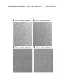 IDENTIFICATION OF ATYPICAL ANTIBODIES IN HUMAN BLOOD AND BLOOD PRODUCTS diagram and image