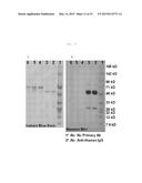 IDENTIFICATION OF ATYPICAL ANTIBODIES IN HUMAN BLOOD AND BLOOD PRODUCTS diagram and image