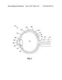 METHODS FOR TREATING RETINOPATHY WITH EXTENDED THERAPEUTIC EFFECT diagram and image