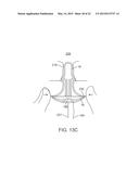 APPARATUS AND METHODS FOR ACCESSING AND SEALING BODILY VESSELS AND     CAVITIES diagram and image