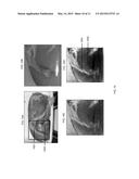 SYSTEM AND METHOD FOR INTRAOPERATIVE DETECTION OF CANCER MARGINS USING     CONFORMAL FILTERS IN A DUAL POLARIZATION CONFIGURATION diagram and image