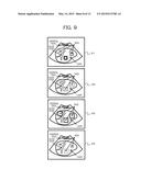 ULTRASONIC DIAGNOSTIC APPARATUS AND ELASTIC EVALUATION METHOD diagram and image