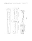 SYSTEM AND METHOD FOR RISK STRATIFICATION BASED ON DYNAMIC  NONLINEAR     ANALYSIS AND COMPARISON OF CARDIAC REPOLARIZATION WITH OTHER     PHYSIOLOGICAL SIGNALS diagram and image